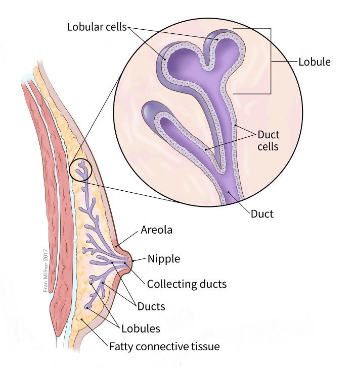 What Is Breast Cancer in Men Male Breast Cancer American