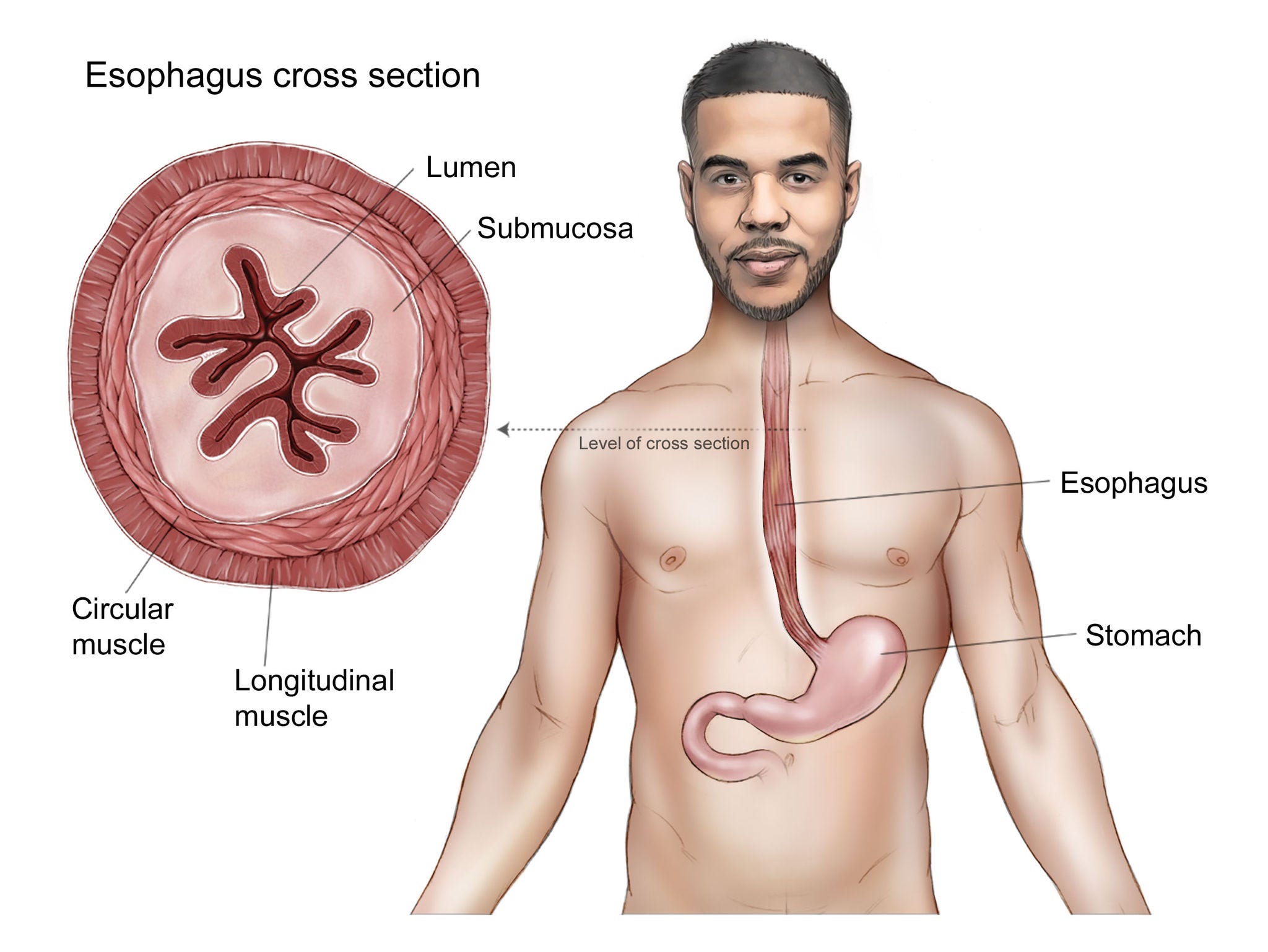 Illustration of a male body showing the location of the esophagus and stomach. Also includes an illustrated cross section of the esophagus with the layers labeled from outside to inside: longitudinal muscle, circular muscle, submucosa, lumen. 