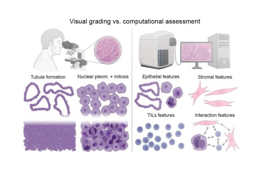 Visual Grading by a Pathologist vs Computational Assessment with HiPS