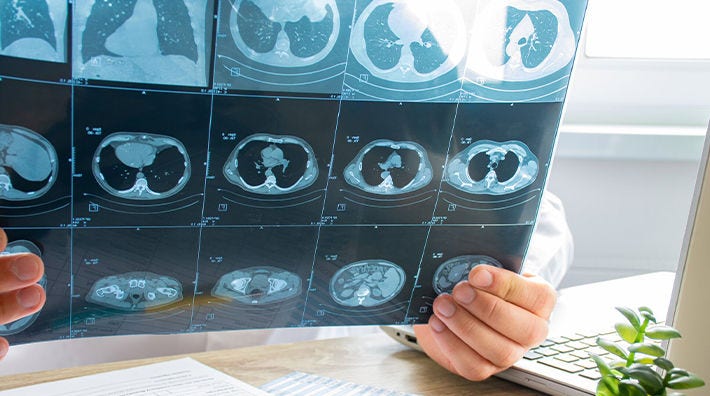 Doctor sitting at desk holds CT scan of chest and abdominal cavity