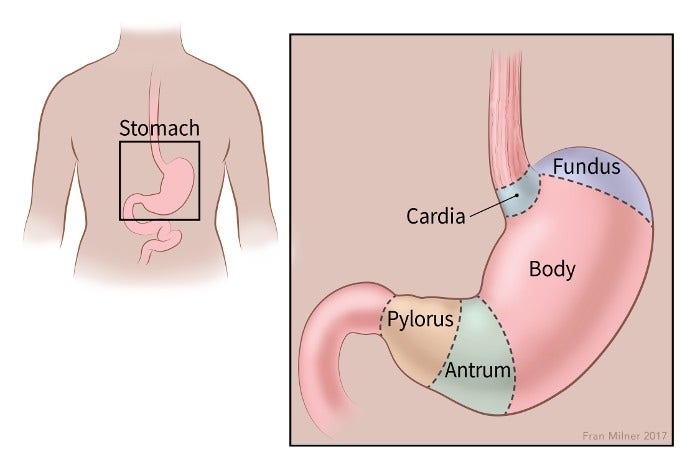 What Is Stomach Cancer?, Types of Stomach (Gastric) Cancer