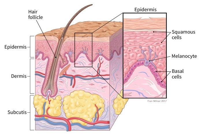 What Are Basal and Squamous Cell Skin Cancers Types of Skin