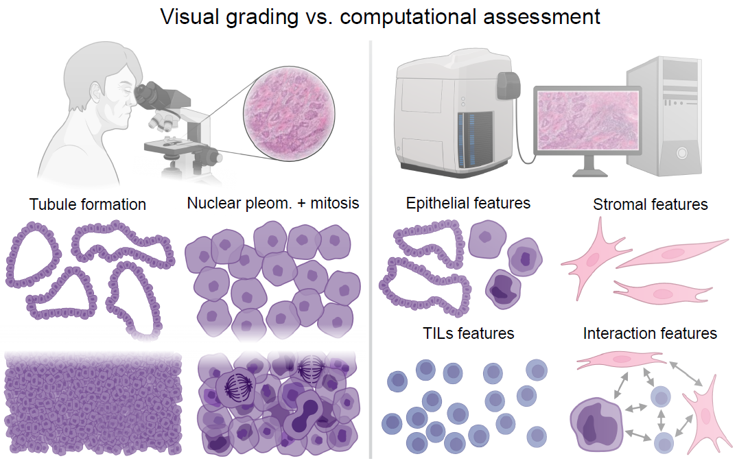 Visual Grading by a Pathologist vs Computational Assessment with HiPS