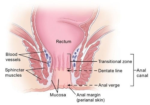 What Is Anal Cancer Types of Anal Cancer American Cancer Society