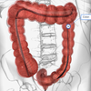 An illustration of the colon shows how a colonoscopy would be performed.