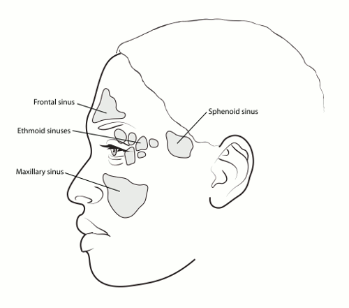 maxillary sinus cancer