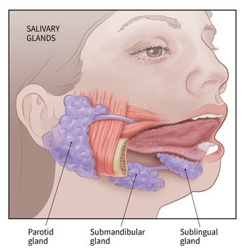 swollen parotid lymph node