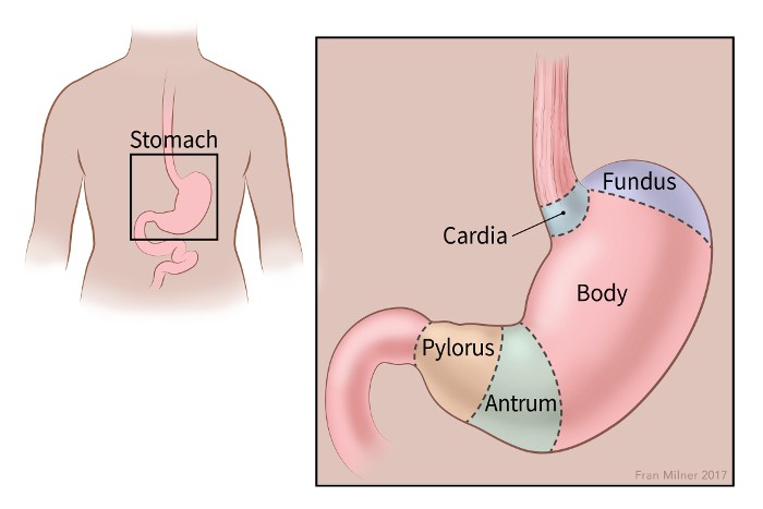 What Is Stomach Cancer Types Of Stomach Gastric Cancer